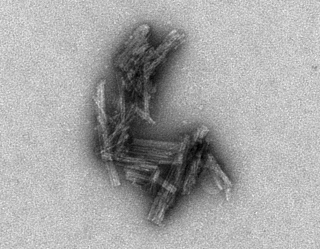 Alzheimer's Breakthroughs